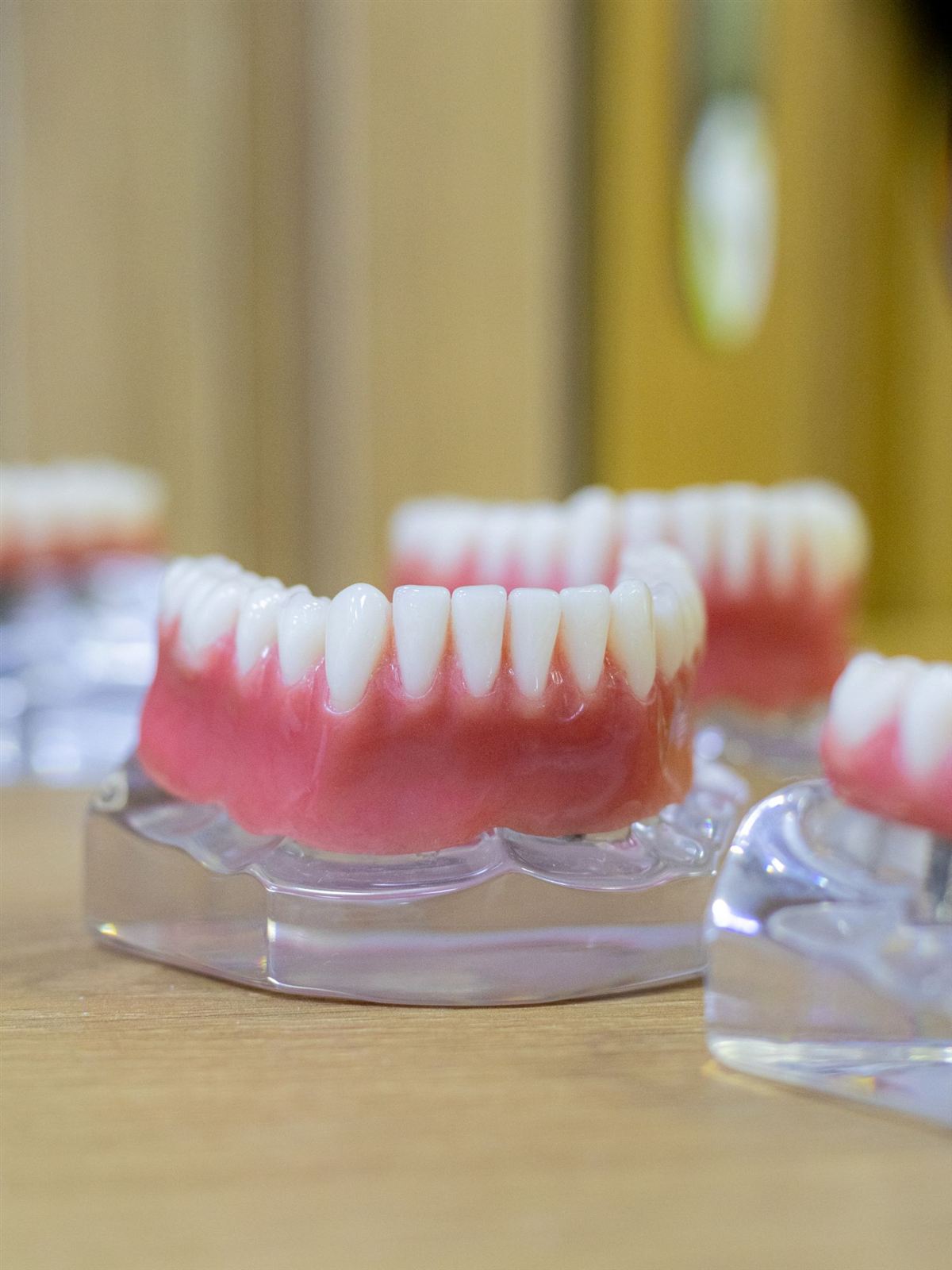Full-arch implant models