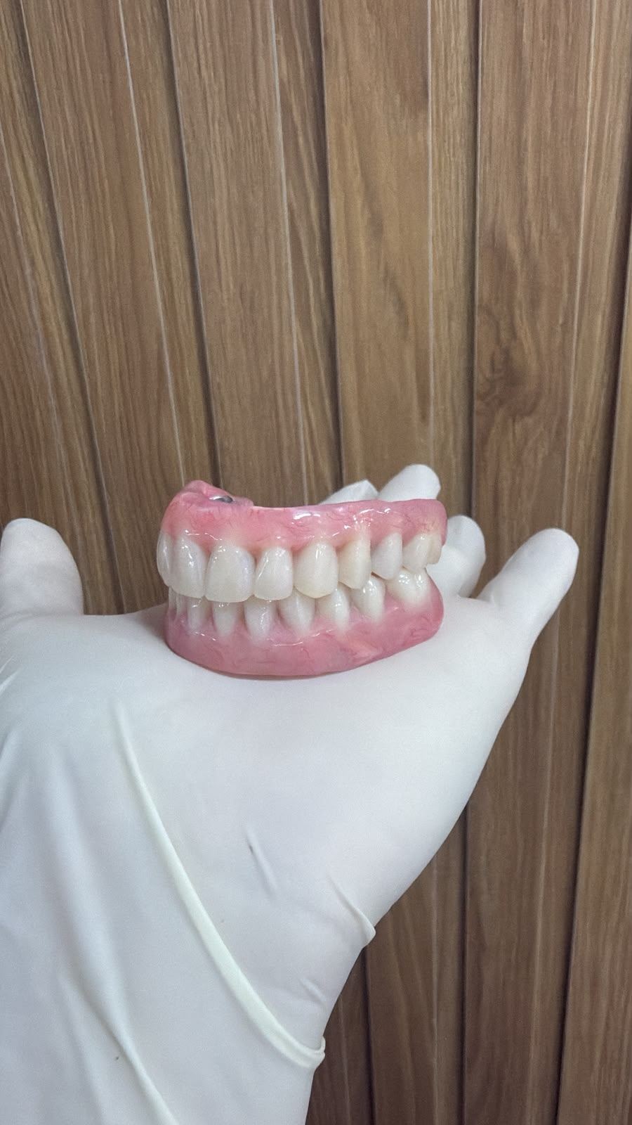 Full-arch implant prosthesis